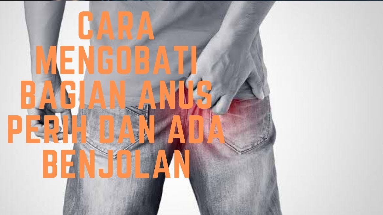 Cara Mengobati Bagian Anus Perih Dan Ada Benjolan - YouTube