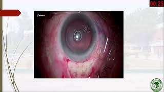 AIOCMT3 2024 - GP6 - Faculty Talks - Cataract Spotlight