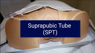 Suprapubic tube (SPT)