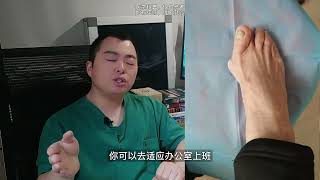 拇外翻矫正，拇外翻手术后多久可以上班？hallux valgus