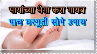 टाचेच्या भेगा रात्रीतून गायब,जादूई आयुर्वेदिक उपाय,split heel remedy,एडी के दर्द से छुटकारा