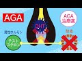 aga 男性型脱毛症 で薄毛になる仕組み、薬治療で髪が生える理由を教えます！