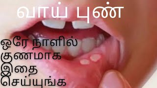 வாய்புண் வேகமாக குணமாக இதை செய்யுங்க // வாய் புண் வீட்டு மருத்துவம் // Home Remedy for mouth ulcer