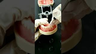 Exploring Anterior Teeth (what end is correct?)