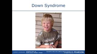 Chapter 35 Patients with Special Challenges