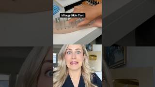 THIS is how allergy testing works