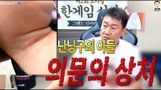 난닝구 [ 어린이집에서 일어난 의문의 둘째아이 상처사건 누구의 소행일까? ]