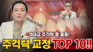 수술 없이 교정만으로 이게 가능하다고?? 역대급 주걱턱교정 Top10