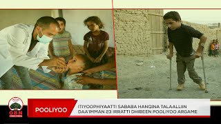 Itiyoophiyaatti sababa hanqina talaalliin daa’imman 23 irratti dhibeen Pooliyoo argame