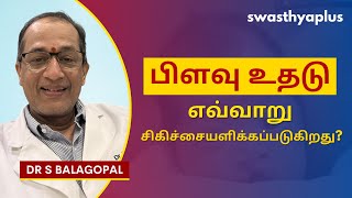 பிளவு உதடு / பிளவு அண்ணம் என்றால் என்ன? | Treatment of Cleft Lip in Tamil | Dr S Balagopal