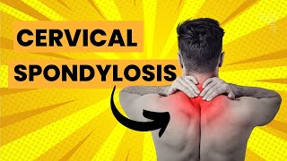 Cervical Spondylosis- Exercises & Stretches for Neck Pain & Arthritis