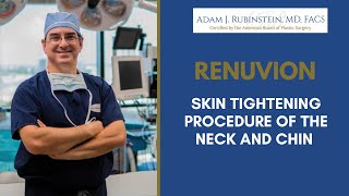 Renuvion of the Neck treatment with one week before and after results!