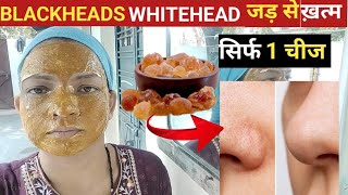 सिर्फ 15 मिनिट में blackheads,whiteheads, unwanted facial hair को जड़ से हटाए।0 बजट फेस मास्क।