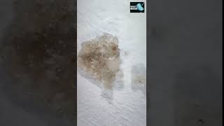 Dandruff under microscope 🔬🧐🔬 #microscopy #hair #dandruff #dust#music