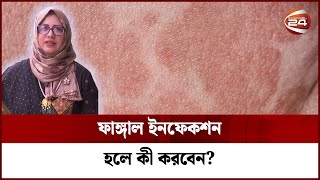 গরমে বেড়ে যায় ফাঙ্গাল ইনফেকশন, কী করা উচিৎ? | Fungal Infection | Dr Fahmida | Channel 24