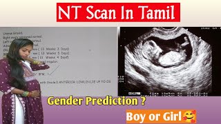 |My first trimester NT Scan @Rathi_Media |NT Scan Report details in tamil|NT scan in 3 months|