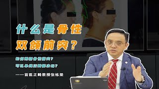 骨性双颌前突可以单纯正畸改善吗？矫正必看！