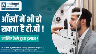 Eyes Tuberculosis in Hindi | आँख की टीवी लक्षण इलाज़ और बचाव - Dr Preeti Agarwal