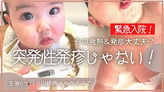 【川崎病】緊急入院！突発性発疹じゃなかった、、生後6ヶ月初めての高熱\u0026発疹、入院記録/三姉妹ママ