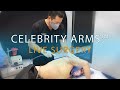 Arm Liposuction Live Surgery | Immediate Results | Celebrity Arms™ | Lipo 360 Arms | Expert Dr. Su