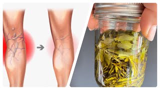 Unbelievable! Varicose veins disappear with rosemary! Treasure that everyone should have.