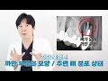 임플란트 뼈이식 모르고 했다가 잇몸 싹 녹아내릴 수 있습니다.