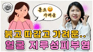 대구포항구미울산창원안동경주 지루성피부 치료 가능한가요?🤔 / 안면홍조 따갑고 가려운 얼굴피부염😡 / 열감,진물동반 피부과 항히스타민제 스테로이드 면역억제제 효과없다면 치료법은?