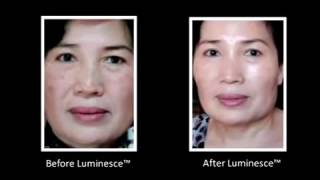 美商婕斯賦活青春精華露用前用後相片比較  Jeunesse LUMINESCE Cellular Rejuvenation Serum REVIEW Before \u0026 After Photos