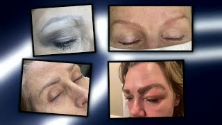 Missouri officials eye legislation after News 4 Investigation on beauty procedure