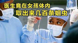 医生竟在女孩体内取出几百条蛔虫【影视】