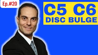 Ep20. EXERCISES For C5/C6 Disc Bulge, Reversed Cervical Lordosis, Neck Pain | Dr. Walter Salubro