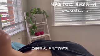 针灸治疗covid 19 后味觉 嗅觉消失一例