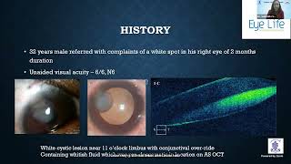 Update series on Ocular Trauma   Dr  SUSMITA G  SHAH