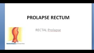 Surgery Rectal prolapse rectum Procidentia Intussuception