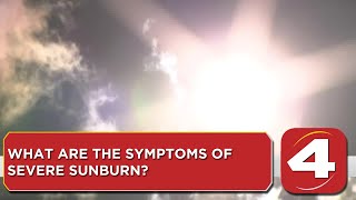 What are the symptoms of severe sunburn?