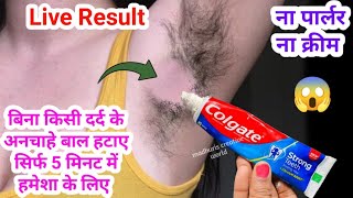 stop Shaving👉 ये मामूली सी चीज दाढ़ी,मूछ को ऐसे साफ किया😱हैरान हूं || facial hair removal at home 😱👍