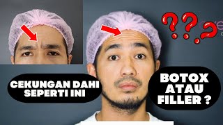 Suntik Botox Before and After DAHI (Bikin AUTO AWET MUDA) - Ovela Clinic