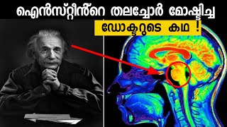 Twisted Story Of Albert Einstein's Brain |ഐൻസ്റ്റീൻ്റെ തലച്ചോർ മോഷ്ടിച്ച ഡോക്ടറുടെ കഥ! Storify