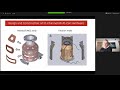 s4 p01 imaging human brain function with minimal mobility restrictions michael garwood