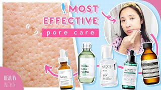 Best Products + Ingredients to Get Rid of Large Clogged Pores, Acne & Breakouts