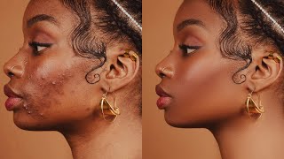 High-End Skin Retouching Beginner Photoshop Tutorial | Frequency Separation