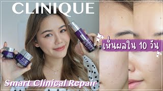 REVIEW กันแก่ไว้ก่อน ด้วย Clinique Smart Clinical Repair ผิวเด็กอย่างสมาร์ทจากสกินแคร์ | Wonderpeach