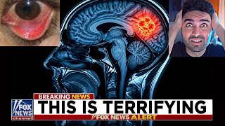 He Ate Indian Food, Then Got Worms in His Brain ‼️😲