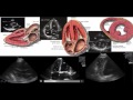 ultrasound education in biochemistry wet beriberi