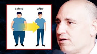 Heart Surgeon REVEALS How He Lost 100 POUNDS! | Dr. Philip Ovadia