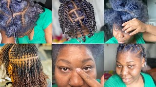 Dry and itchy skin 😤|| Sisterlocks or locks? #skin