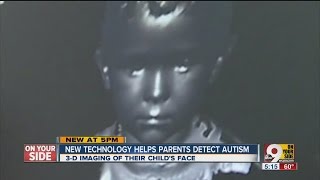 Diagnosing autism: Researchers see promise in 3-D imaging of child's face