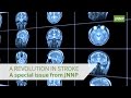 A Revolution in Stroke: JNNP special issue