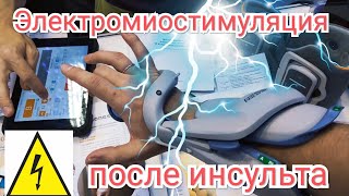 Восстановление кисти после инсульта - Электростимуляция