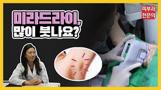 미라드라이 붓기는 얼마나 갈까? [피부과 전문의]